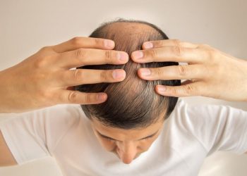 Troubled by white hair and hair loss at a young age, this recipe will solve your problem