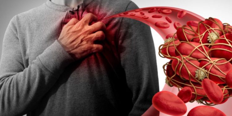 Causes Blood Clots: किस विटामिन की कमी से बनते है खून के थक्के?  सेहत के लिए फायदेमंद साबित होगा ये Vitamin